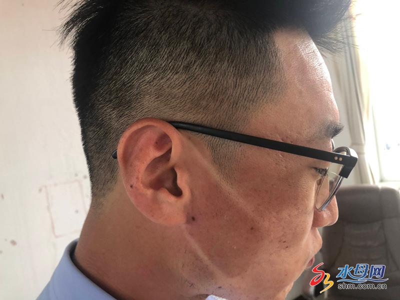 他才发现,自己因为在烈日下长期暴晒,脸已经被晒黑,唯独戴口罩的部位